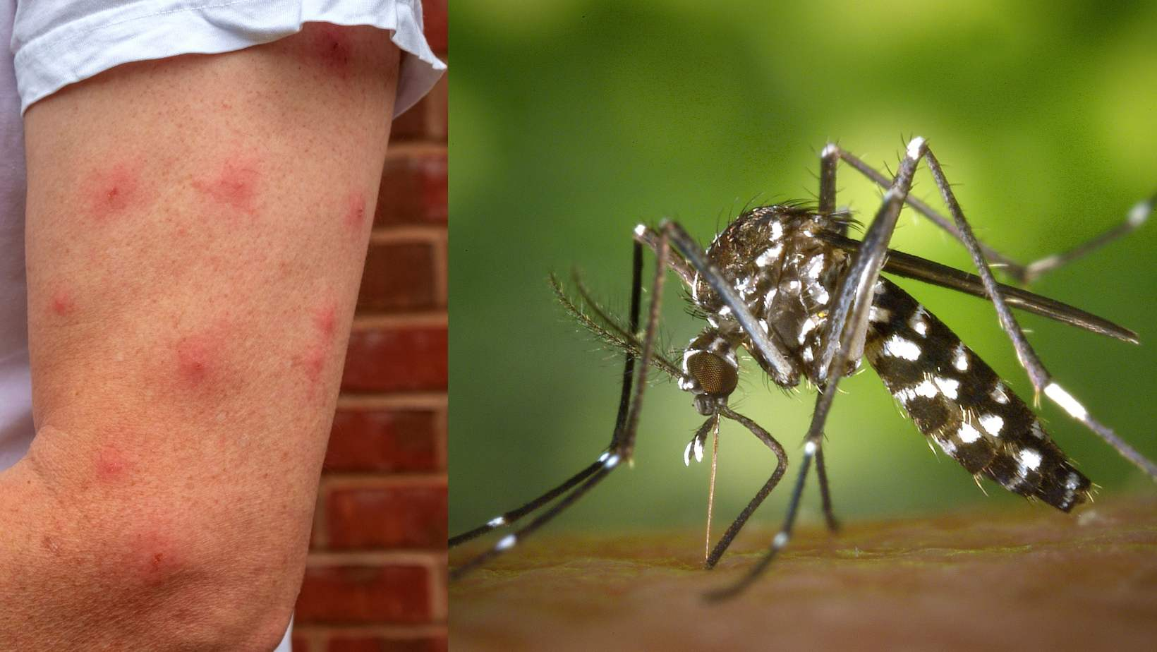 750 000 morts par an : comment se protéger des moustiques, ces tueurs silencieux, avec 3 solutions naturelles